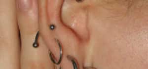 Pierced Ear Pain